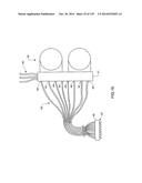 HEMODIALYSIS SYSTEMS AND METHODS diagram and image