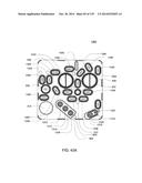 HEMODIALYSIS SYSTEMS AND METHODS diagram and image