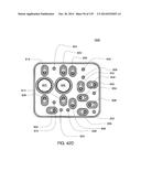 HEMODIALYSIS SYSTEMS AND METHODS diagram and image