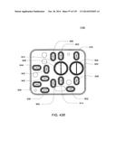 HEMODIALYSIS SYSTEMS AND METHODS diagram and image