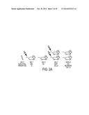 EFFECTIVE TARGETING OF PRIMARY HUMAN LEUKEMIA USING ANTI-CD123 CHIMERIC     ANTIGEN RECEPTOR ENGINEERED T CELLS diagram and image