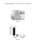 OSTEOPROTEGERIN IN NEUROPROTECTION diagram and image