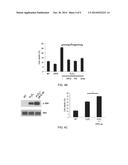 OSTEOPROTEGERIN IN NEUROPROTECTION diagram and image