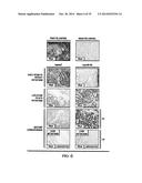 TISSUE & BLOOD-BASED MIRNA BIOMARKERS FOR THE DIAGNOSIS, PROGNOSIS AND     METASTASIS-PREDICTIVE POTENTIAL IN COLORECTAL CANCER diagram and image