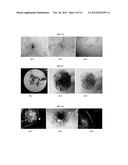 HUMAN HOMEOBOX GENE VENTX AND MACROPHAGE TERMINAL DIFFERENTIATION AND     ACTIVATION, COMPOSITIONS AND METHODS THEREOF diagram and image