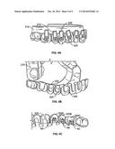 SYSTEMS AND METHODS FOR FABRICATING A DENTAL TEMPLATE diagram and image