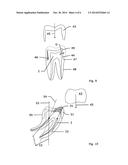 METHOD AND SYSTEM FOR ESTABLISHING THE SHAPE OF THE OCCLUSAL ACCESS CAVITY     IN ENDODONTIC TREATMENT diagram and image