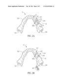 GUIDING TEMPLATE FOR DENTAL IMPLANTOLOGY diagram and image