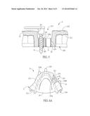 GUIDING TEMPLATE FOR DENTAL IMPLANTOLOGY diagram and image