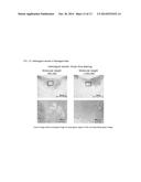 CARTILAGE PRODUCTION PROMOTER AND PROPHYLACTIC OR THERAPEUTIC AGENT FOR     DISEASES ASSOCIATED WITH CARTILAGE DAMAGE diagram and image