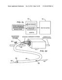 IMAGING PROBE WITH COMBINED ULTRASOUND AND OPTICAL MEANS OF IMAGING diagram and image