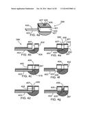 IMAGING PROBE WITH COMBINED ULTRASOUND AND OPTICAL MEANS OF IMAGING diagram and image