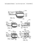 IMAGING PROBE WITH COMBINED ULTRASOUND AND OPTICAL MEANS OF IMAGING diagram and image