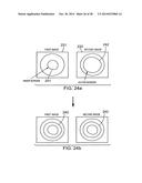 IMAGING PROBE WITH COMBINED ULTRASOUND AND OPTICAL MEANS OF IMAGING diagram and image