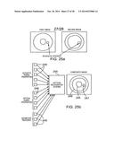 IMAGING PROBE WITH COMBINED ULTRASOUND AND OPTICAL MEANS OF IMAGING diagram and image