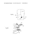 ULTRASONIC IMAGE-GUIDED TISSUE-DAMAGING PROCEDURE diagram and image