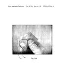 ULTRASONIC IMAGE-GUIDED TISSUE-DAMAGING PROCEDURE diagram and image