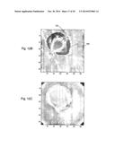 ULTRASONIC IMAGE-GUIDED TISSUE-DAMAGING PROCEDURE diagram and image