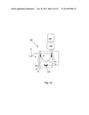 ULTRASONIC IMAGE-GUIDED TISSUE-DAMAGING PROCEDURE diagram and image