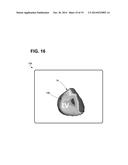 SYSTEMS, METHODS, AND INTERFACES FOR IDENTIFYING EFFECTIVE ELECTRODES diagram and image