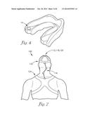 DEVICE AND SYSTEM TO REDUCE TRAUMATIC BRAIN INJURY diagram and image