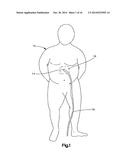 SYSTEMS AND METHODS FOR REMOVING INGESTED MATERIAL FROM A STOMACH diagram and image