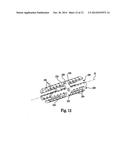 ANCHOR SLEEVE FOR IMPLANTABLE LEAD diagram and image