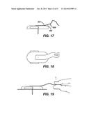 WEARABLE INFUSION DEVICE WITH LOW PROFILE HANDLE diagram and image