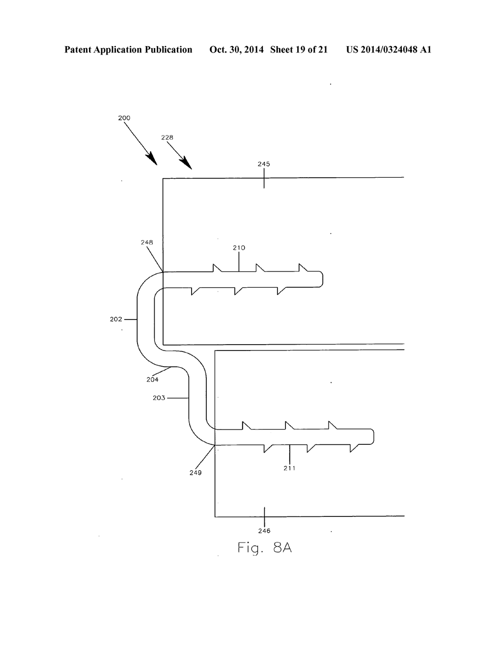 METHODS AND APPARATUS FOR A STAPLE - diagram, schematic, and image 20