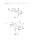 SYSTEM AND METHOD FOR PELVIC FLOOR REPAIR diagram and image