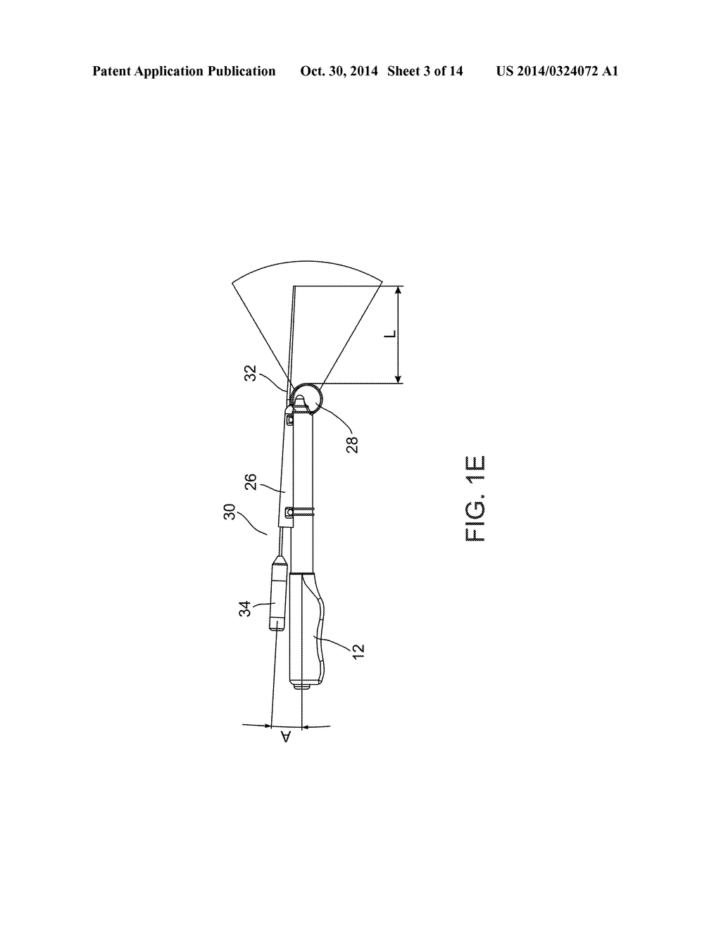 SYSTEM AND METHOD FOR PELVIC FLOOR REPAIR - diagram, schematic, and image 04