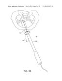 SYSTEM AND METHOD FOR PELVIC FLOOR REPAIR diagram and image