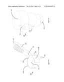 SURGICAL DEVICE diagram and image