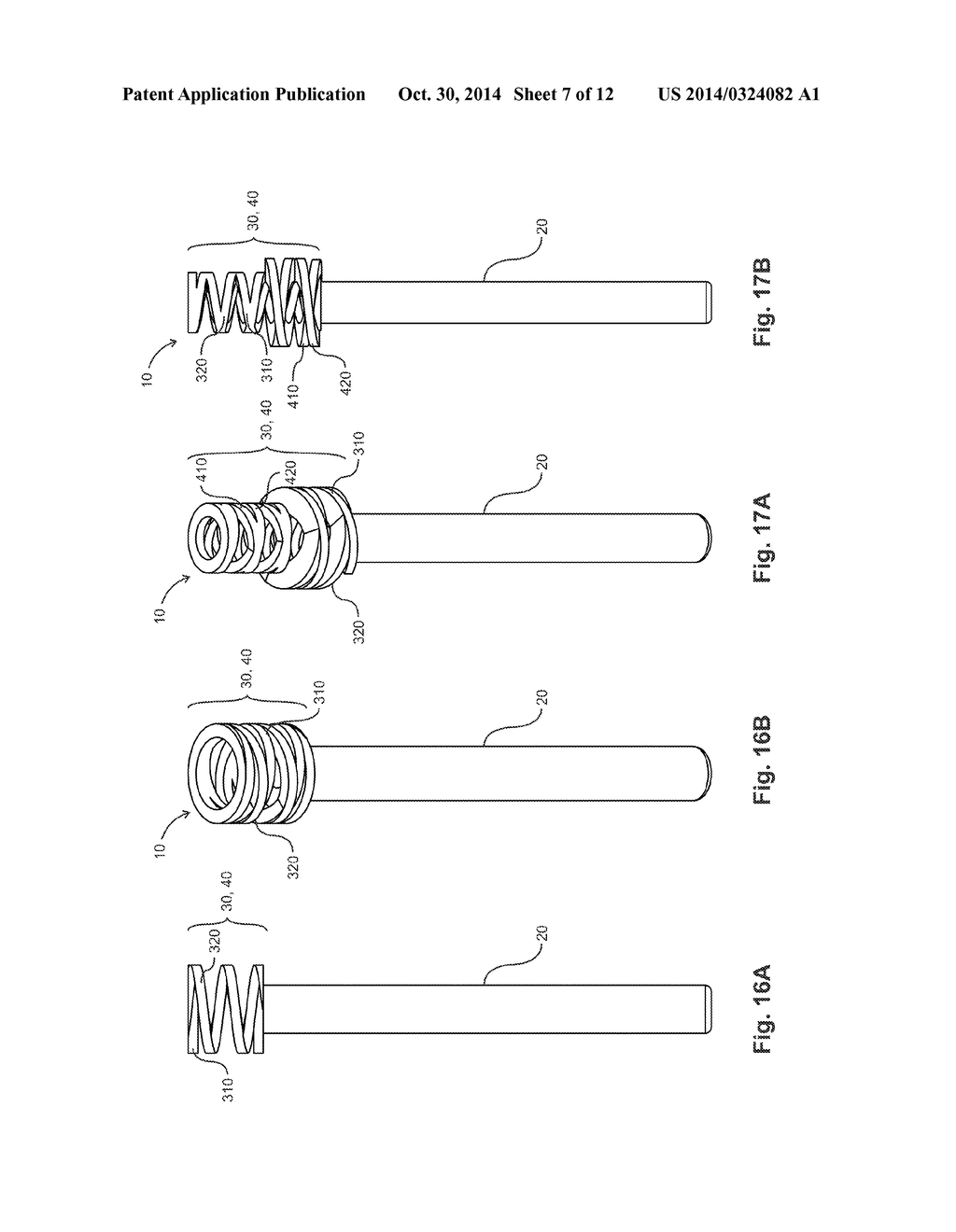 Device and Method for Removing Earwax - diagram, schematic, and image 08