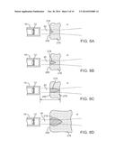 SYSTEM AND METHOD FOR ENERGY DELIVERY TO TISSUE WHILE MONITORING POSITION,     LESION DEPTH, AND WALL MOTION diagram and image