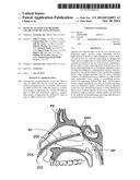 DEVICES, SYSTEMS AND METHODS USEABLE FOR TREATING SINUSITIS diagram and image