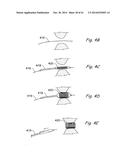 DEVICES, SYSTEMS AND METHODS USEABLE FOR TREATING SINUSITIS diagram and image