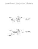 DEVICES, SYSTEMS AND METHODS USEABLE FOR TREATING SINUSITIS diagram and image