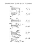 DEVICES, SYSTEMS AND METHODS USEABLE FOR TREATING SINUSITIS diagram and image