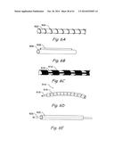 DEVICES, SYSTEMS AND METHODS USEABLE FOR TREATING SINUSITIS diagram and image