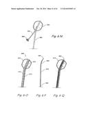 DEVICES, SYSTEMS AND METHODS USEABLE FOR TREATING SINUSITIS diagram and image