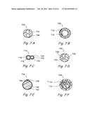 DEVICES, SYSTEMS AND METHODS USEABLE FOR TREATING SINUSITIS diagram and image