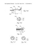 DEVICES, SYSTEMS AND METHODS USEABLE FOR TREATING SINUSITIS diagram and image