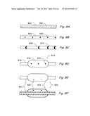 DEVICES, SYSTEMS AND METHODS USEABLE FOR TREATING SINUSITIS diagram and image