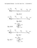 DEVICES, SYSTEMS AND METHODS USEABLE FOR TREATING SINUSITIS diagram and image