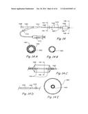 DEVICES, SYSTEMS AND METHODS USEABLE FOR TREATING SINUSITIS diagram and image