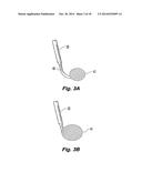 EMBOLUS BLOOD CLOT FILTER WITH BIO-RESORBABLE COATED FILTER MEMBERS diagram and image