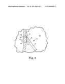 TISSUE STABILIZATION AND REPAIR DEVICE diagram and image