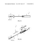 Devices, Systems, and Methods for Suture Management diagram and image