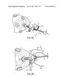 Devices, Systems, and Methods for Suture Management diagram and image